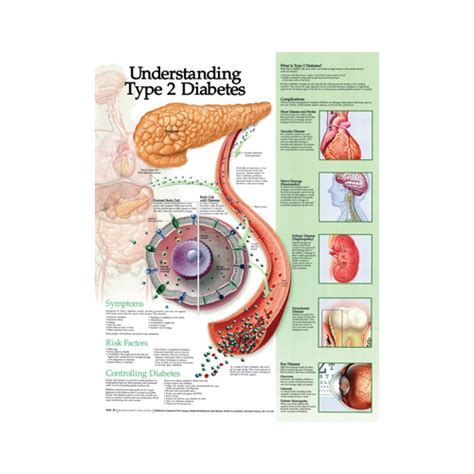 Anatomical Chart Understanding Type 2 Diabetes