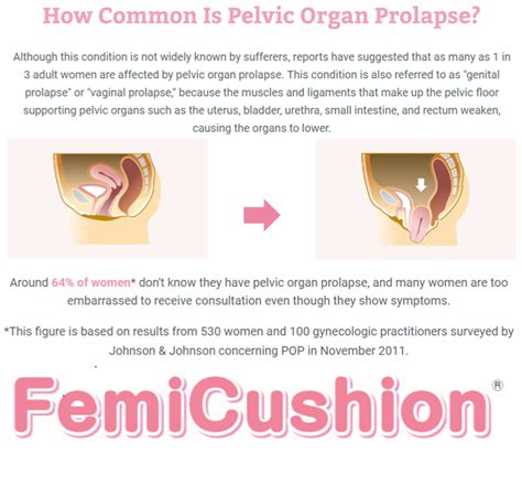 Pin on Pelvic Organ Prolapse: 101