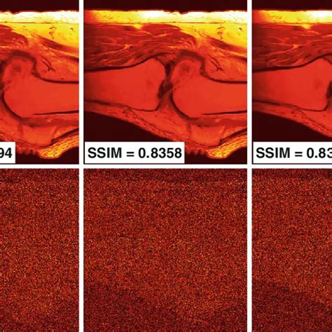 MR Image Denoising For The Proposed Method And Other Competing Methods