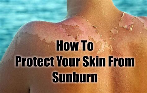 How To Protect Your Skin From Sunburn