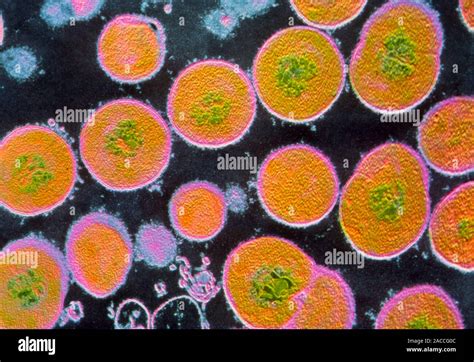 False Colour Transmission Electron Micrograph Tem Of The Gram