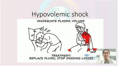 Hypovolemic Shock Introduction Pathology Clinical Features And