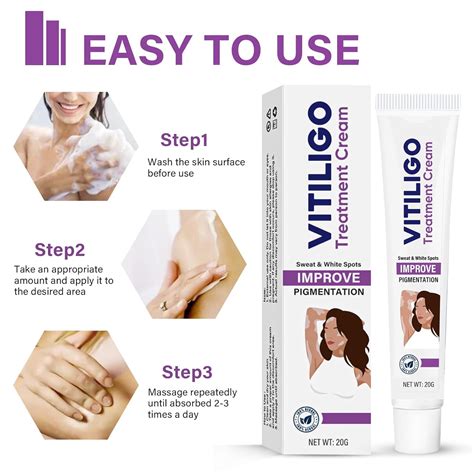 Vitiligo Cream Vitiligo Treatment Cream For Reducefade White Spot And