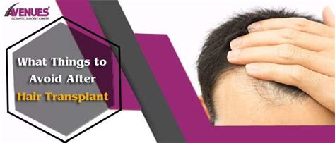 What Things To Avoid After Hair Transplant By Avenues Clinic Medium