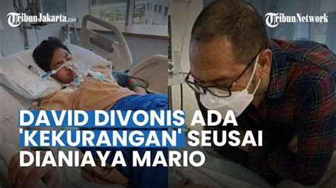 David Divonis Ada Kekurangan Seusai Dianiaya Mario Dandy Jonathan