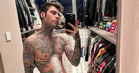 Fedez Mostra La Cicatrice A Un Mese Dall Intervento Ho Perso Quasi