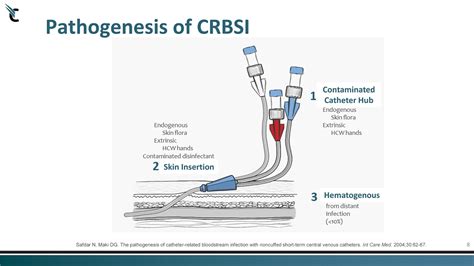 8 Pathogenesis Of Crbsi Safdar N Maki Dg The Pathogenesis Of Catheter