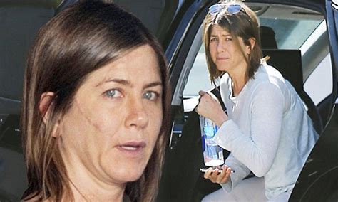 Jennifer Aniston Scar