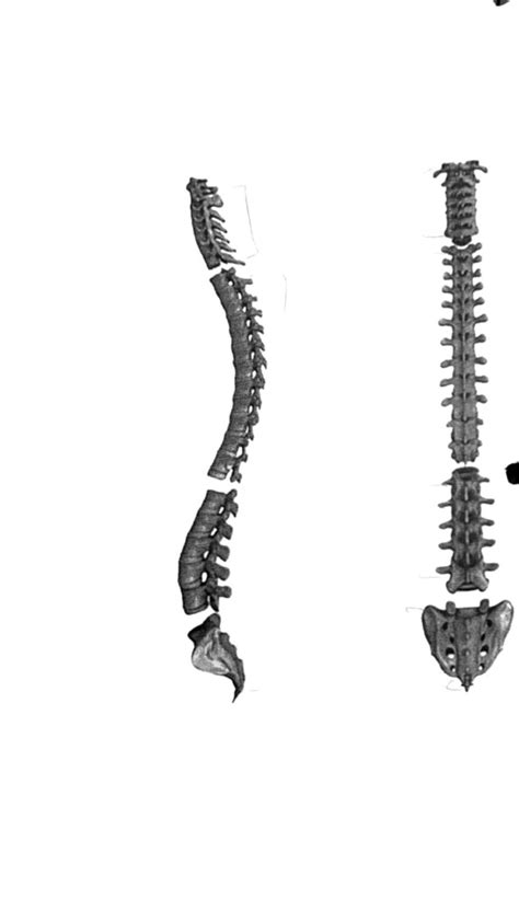 Human Skeletal Vertebral Column Diagram Quizlet