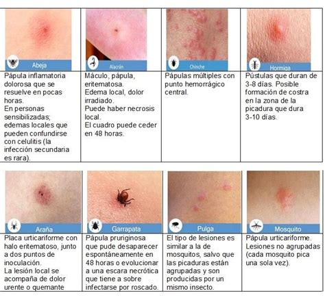 Guía práctica Identifica los diferentes tipos de picaduras de mosquito