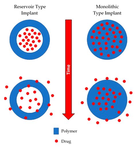 Polymers Free Full Text Implantable Polymeric Drug Delivery Devices