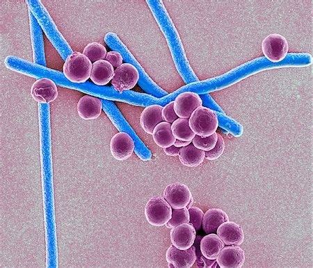 Rod Shaped Bacillus And Round Coccus Bacteria Cancellous Bone