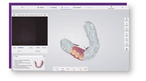 Eletra Smart Scanner Dd Dental