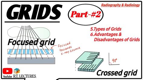 Grids In Radiology Part 2 Anti Scatter Grid Grid Used In