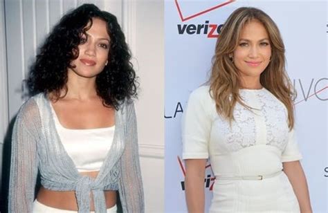 Jennifer Lopez before and after plastic surgery 05 – Celebrity plastic ...