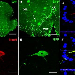 Formation of a heterokaryon in the spinal cord. (A) A motor neuron that ...