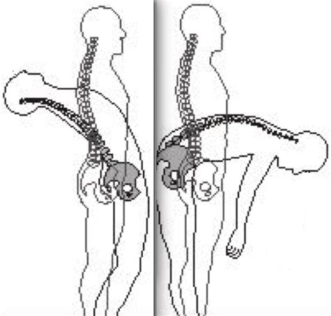 Spinal Extension Vs Flexion Clarification R Flexibility