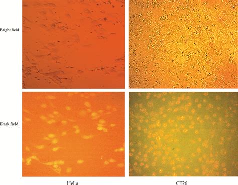 Preparation And Evaluation Of Doxorubicin Loaded PLAPEGF IJN