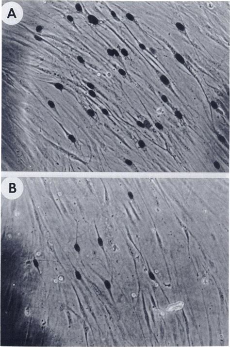 Response Of Human Foreskin Fibroblasts To Microinjection Of Ras