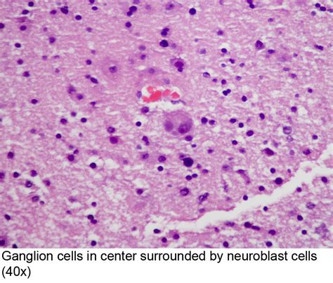 Ganglion Cells Histology