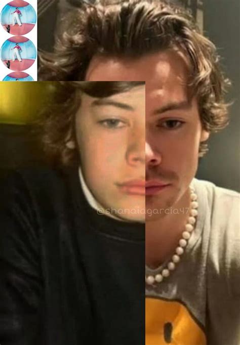 Fetus Harry Styles X Now Harry Styles