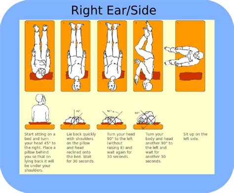 Printable Vertigo Exercise Chart