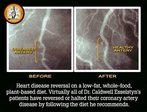 Prevent And Reverse Heart Disease Caldwell Esselstyn Boekbespreking