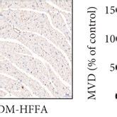 The Influence Of Hg Hffas On Cmecs A The Representative Mitral Flow