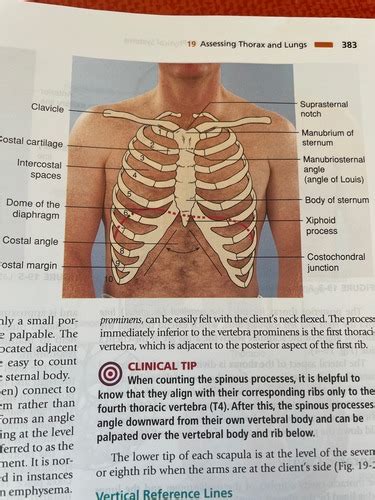 Ch Assessing Thorax And Lungs Flashcards Quizlet