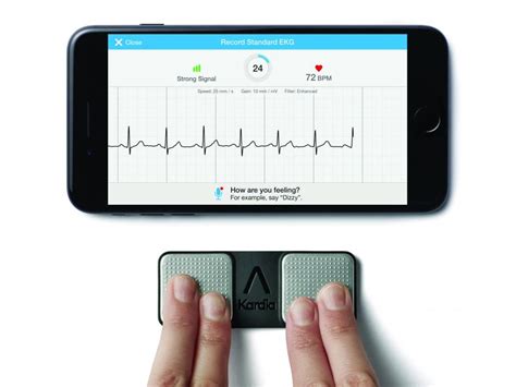 Device Review: Kardia Mobile ECG - 4 star rating | Australian Doctor Group