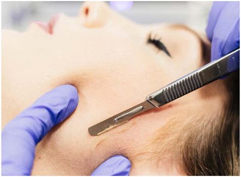 Dermaplaning Precision Spa