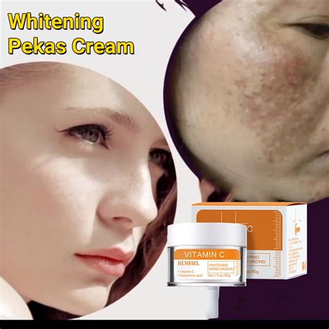 Hemeiel Vitamin C Cream Melasma Removal Melasma Treatment Melasma