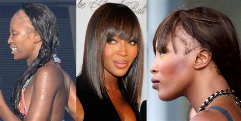 Naomi Campbell hair loss | BlackDoctor