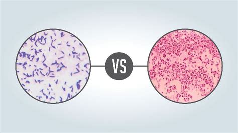 Gram Positive Vs Gram Negative Technology Networks