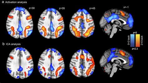 Fractionating The Default Mode Network Distinct Contributions Of The Ventral And Dorsal