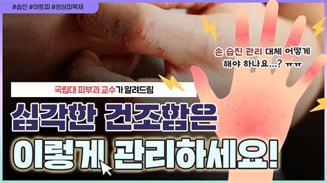 일반 크림으로는 도저~히 해결되지 않는 주부습진 🏻대체 어떻게 관리하나요😥｜주부습진손 습진 관리방법 알려드림 언니네