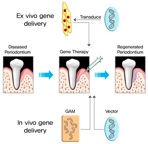 Pharmaceutics Free Full Text Bmp 2 Gene Delivery Based Bone