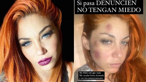 El Nuevo Mensaje De Lourdes De Bandana Tras Denunciar Por Violencia A Su Ex