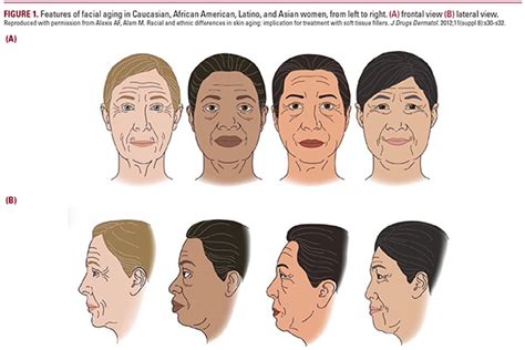 Ethnicity And Aging Skin Scientific Peer Reviewed Dermatology Article