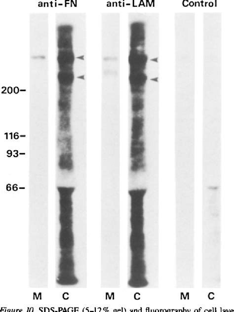 Figure From Diverse Effects Of Fibronectin And Laminin On Phenotypic