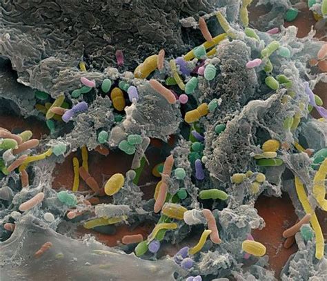 Micrograf A A Color De Las Bacterias Que Habitan En Nuestro Intestino