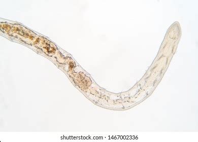 115 Earthworm Under Microscope Images, Stock Photos & Vectors | Shutterstock