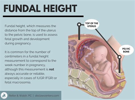 Intrauterine Growth Restriction Iugr Pediatric Nursing Obstetrics