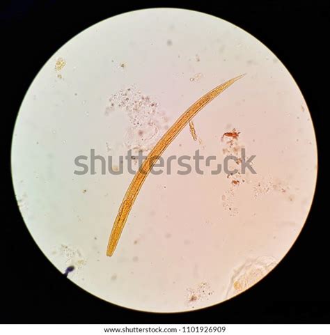 Human Parasite In Stool Under 40x Light Microscopy Strongyloides Stercoralis Is A Human