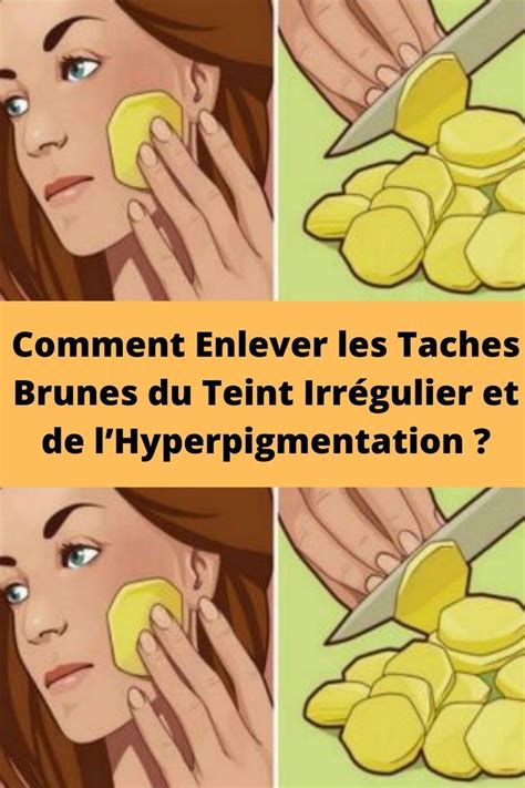 Taches Brunes Comment Enlever Les Taches Brunes Du Teint Irr Gulier