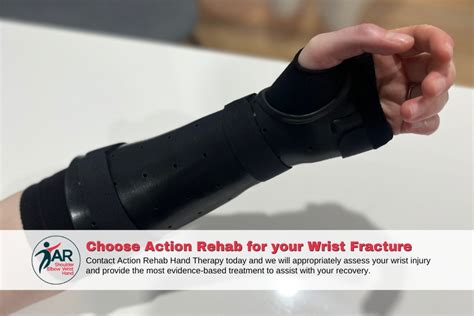 Distal Radius Fracture Treatment | Action Rehab Hand Therapy