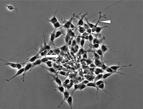 SH SY5Y Cell Line Culture Protocol And Research Applications AcceGen