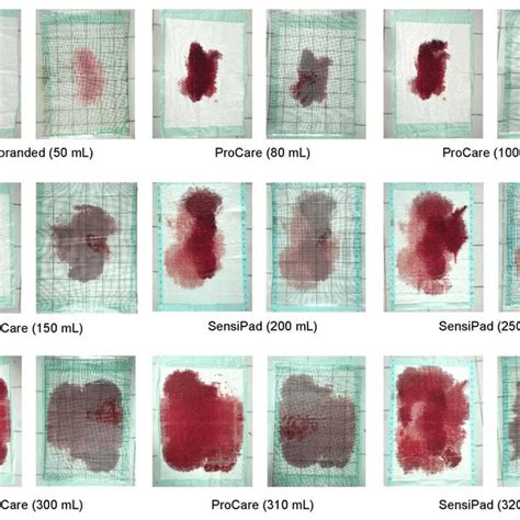 Blood Spills From The Different Volumes On Different Underpads Equipped