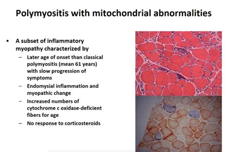 Myositis Rheumnow