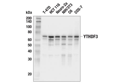 YTHDF3 E2J9I Rabbit MAb Cell Signaling Technology